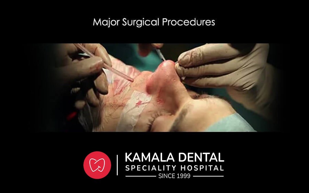 Major Surgical Procedures