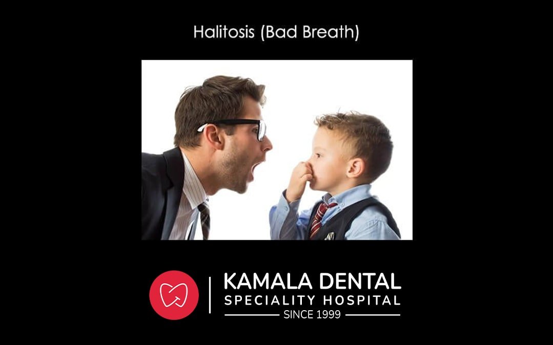Halitosis(Bad Breath)