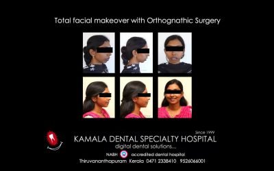 Total facial makeover with orthognathic surgery