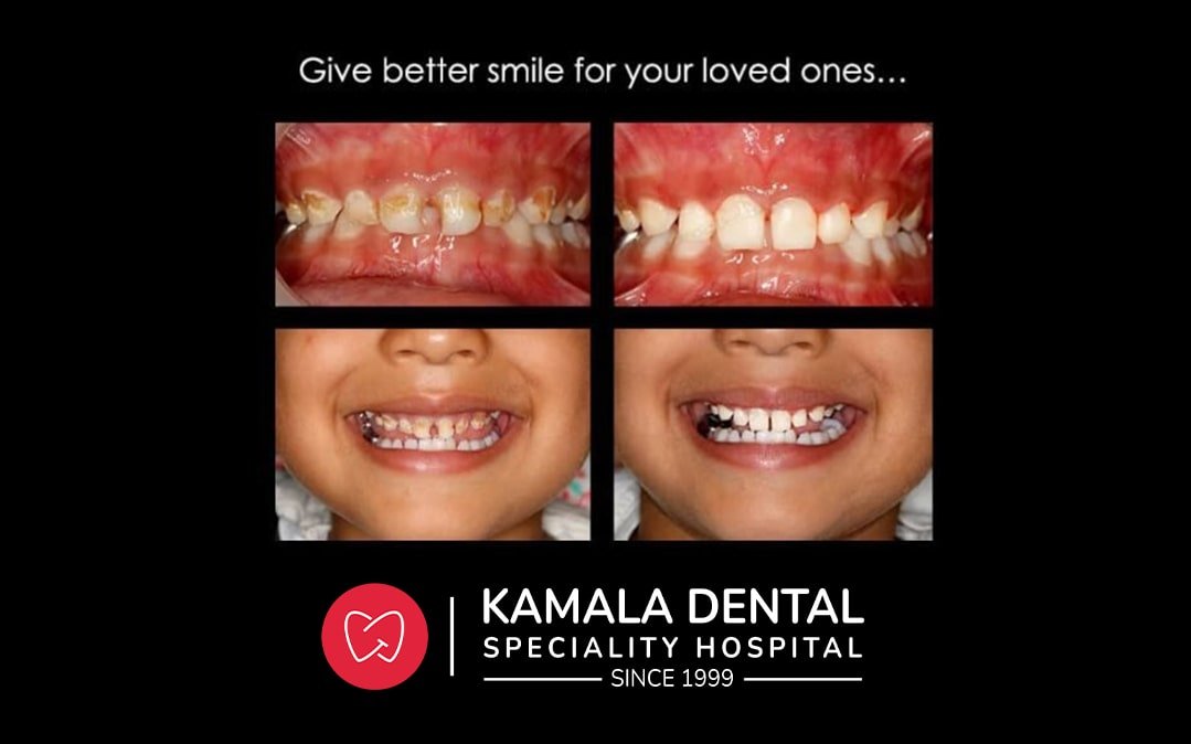 Give better smile for your loved ones…