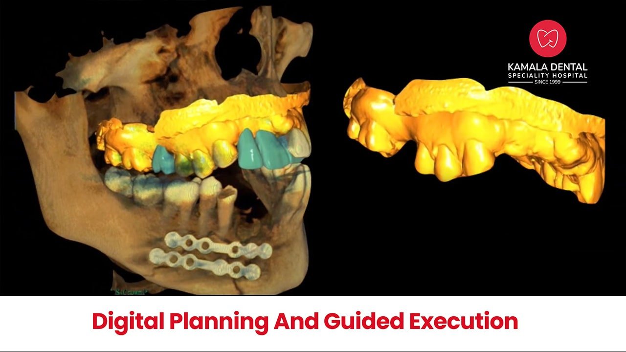 Digital Planning and Guided Execution- Precise and Predictable.