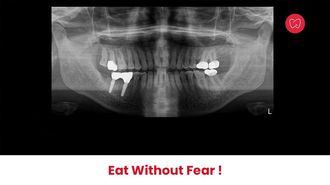 Eat without fear!