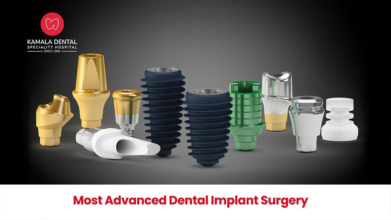 Most Advanced Dental Implant Surgery Kamala Dental, Trivandrum, Kerala, India.