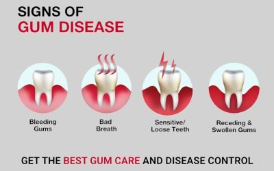 Early signs of gum diseases