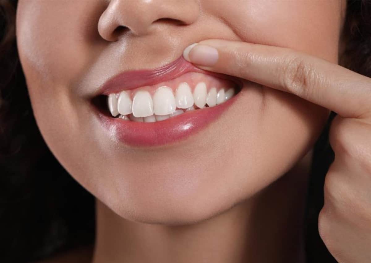 Healthy Gums, Happy Smile: 5 Best Practices to Prevent Gum Disease